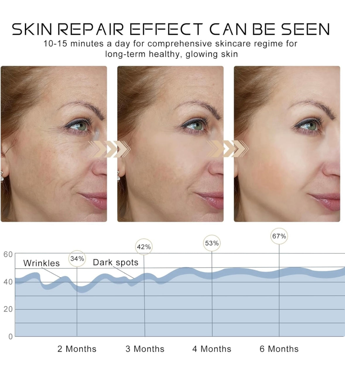 LED Light Therapy Face Mask